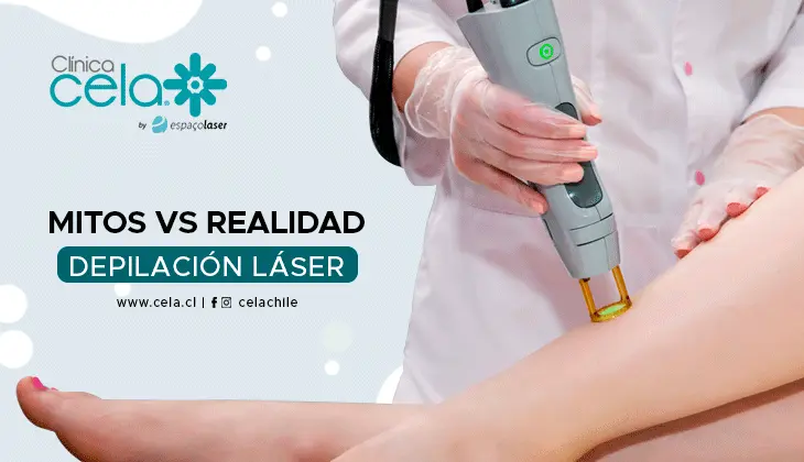 Mitos de la Depilación Láser VS Realidad