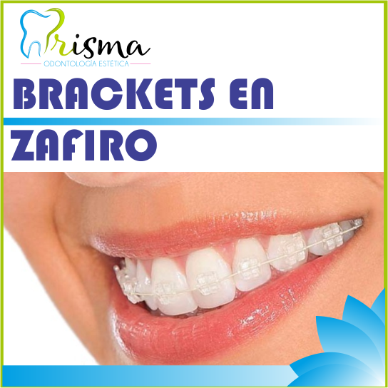 BRACKETS ZAFIRO ESTÉTICOS